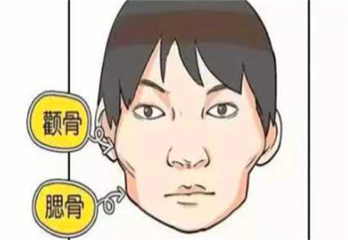 颧骨整形卡通图