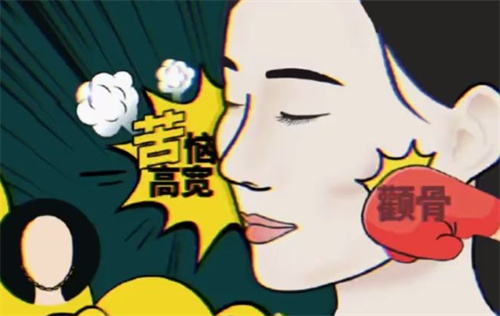 颧骨颧弓示意图