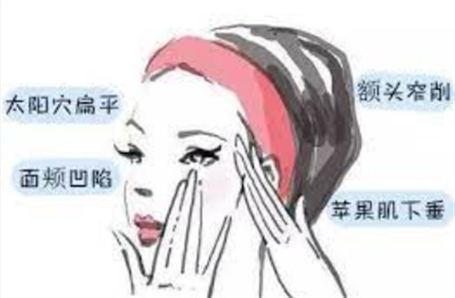 颧骨内推卡通图
