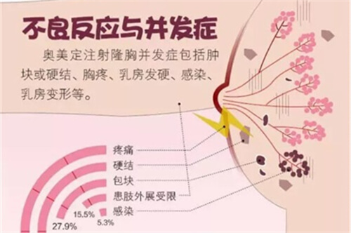 丰胸手术奥美定不良反应及并发症