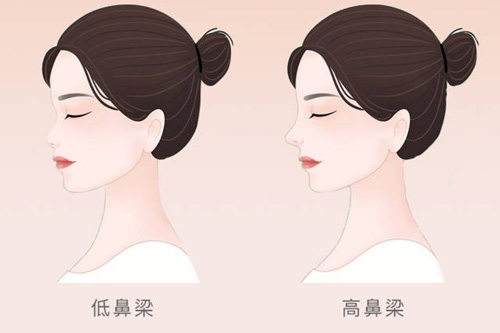 低鼻梁和高鼻梁对比图