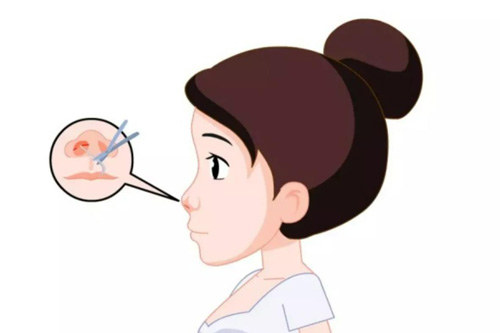 鼻整形内部图
