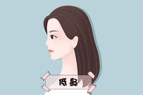 低鼻示意图