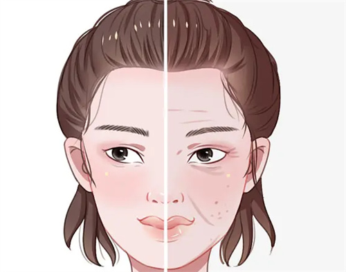 面部轮廓提升对比示意图