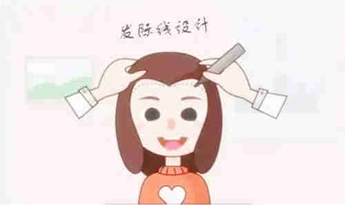植发设计图示