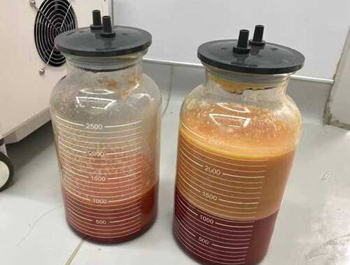 吸脂手术吸出脂肪实物图