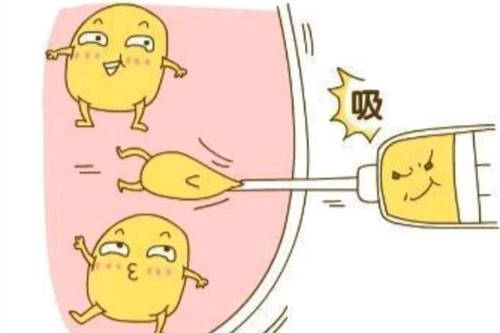 吸脂漫画示意图