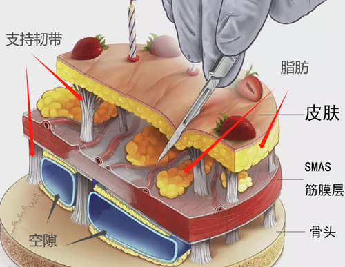 皮肤筋膜层卡通图
