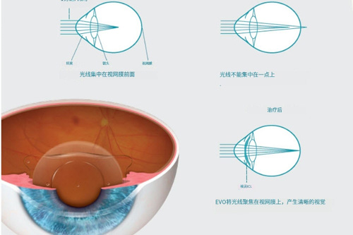 晶体成像解释图