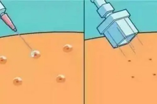 水光微针前后对比图