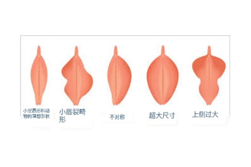 阴蒂示意图