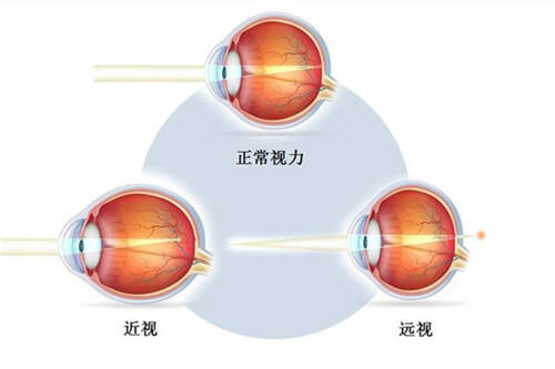 不同视力对比图