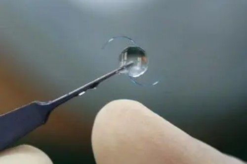 晶体植入近视手术展示图