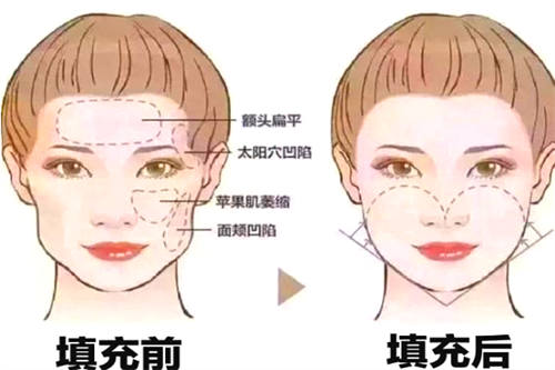 填充前后对比图