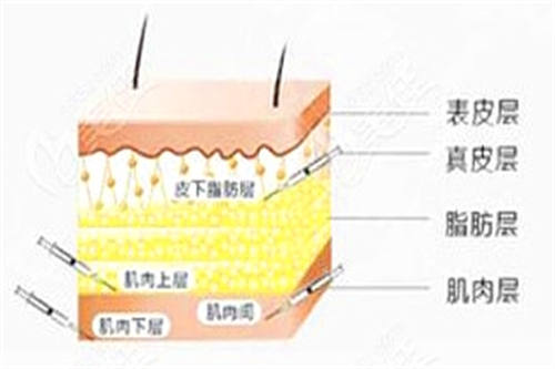 人体结构层图