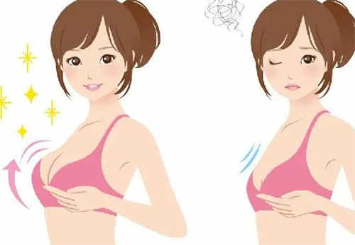 隆胸卡通前后对比示意图