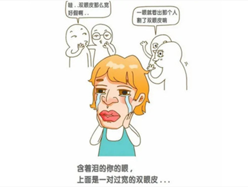 双眼皮修复卡通图