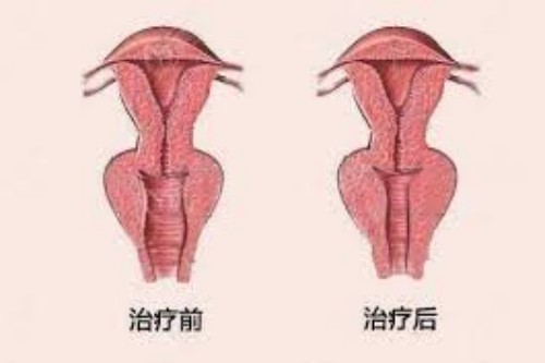如何能让下面变紧