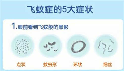 飞蚊症的五种症状