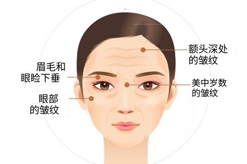 童颜针使用部位图