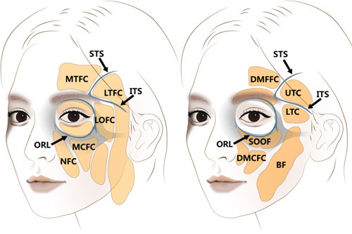 年轻和衰老后的面部脂肪区变化 年轻和衰老后的面部脂肪区变化