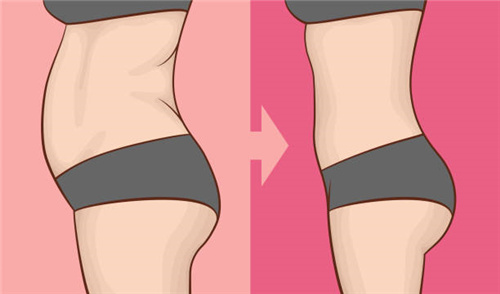 腰腹吸脂前后对比