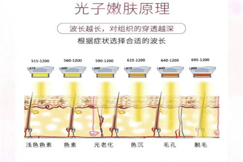 光子嫩肤原理图