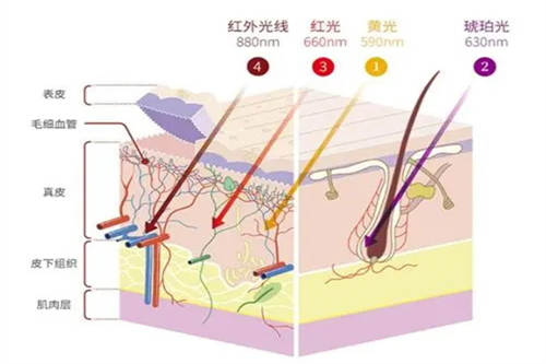 光子嫩肤不同光照射图