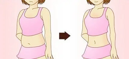 腰腹吸脂卡通图