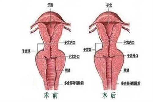 阴道部位图
