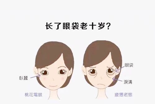 逼自己看完去眼袋超好的医院排名表,国内各地祛眼袋好医院轻松拿捏