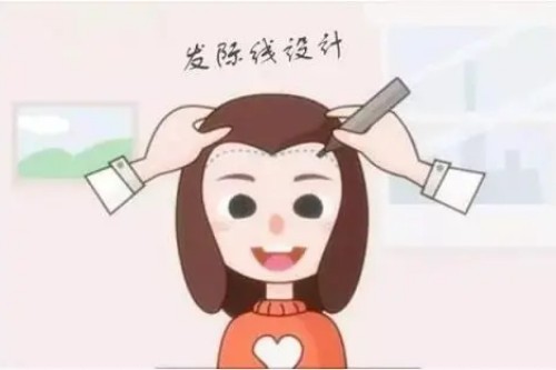发际线种植展示图