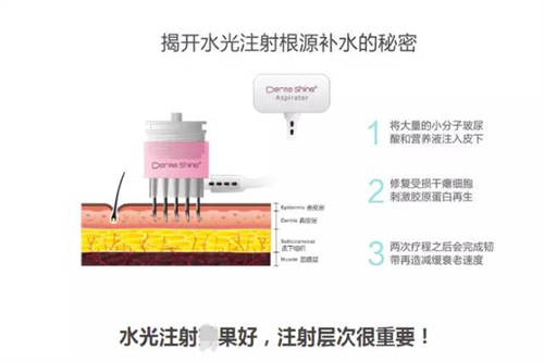 注射水光解析图