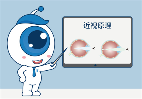 眼睛近视原理