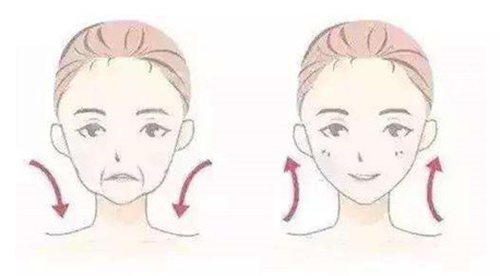 面部拉皮示意图