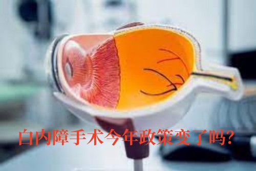 白内障手术今年政策变了吗？