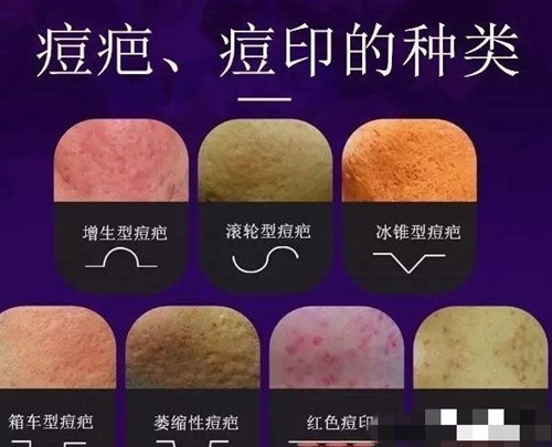 疤痕治疗图片