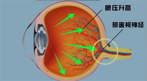 甘肃爱尔眼视光医院是公办的吗?私立民营正规牙科|屈光+白内障+青光眼+眼底病+斜弱视及小儿眼科