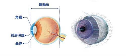全光塑手术原理