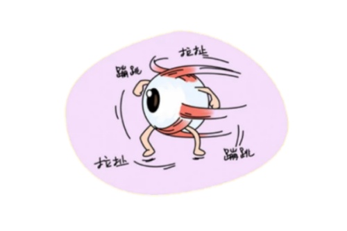 眼球震颤卡通图