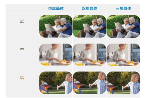 白内障晶体植入单焦点晶体与多焦点晶体区别