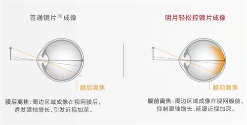 明月轻松控镜片成像