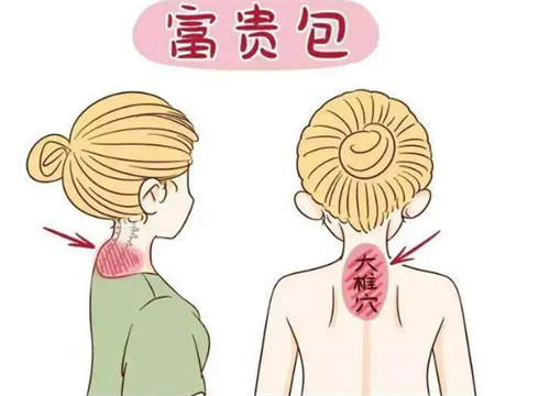 富贵包位置图示