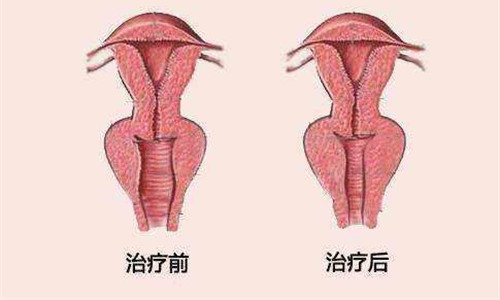 私密治疗对比图