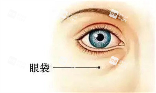 眼袋