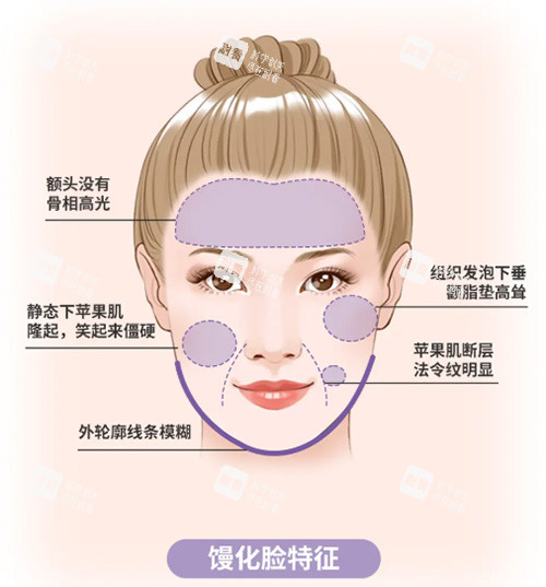 馒化脸怎么办