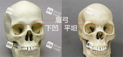 眉弓骨对比展示骨骼图