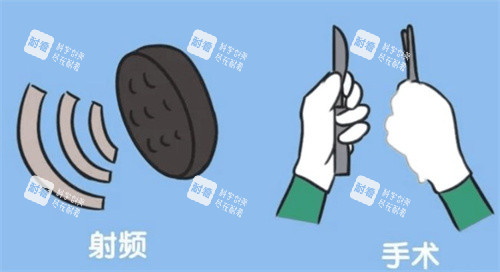 阴道紧缩有射频和手术多种方式