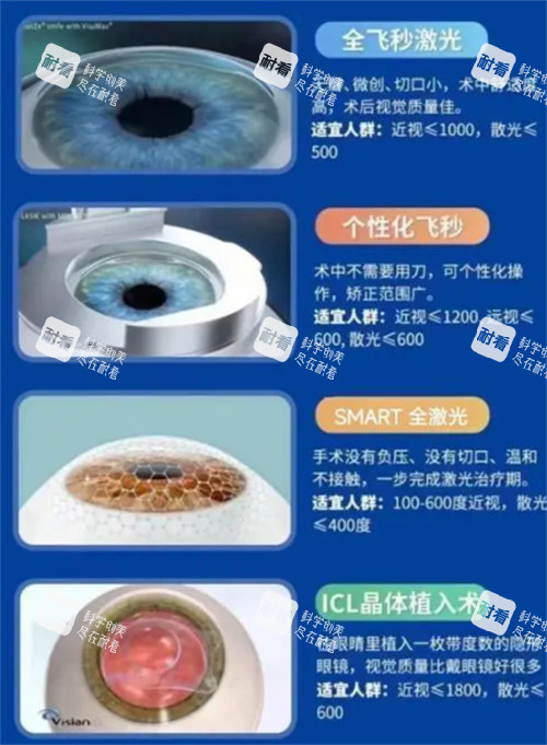 不同近视手术类型适宜人群图解