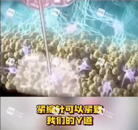 紧缩针怎么样
